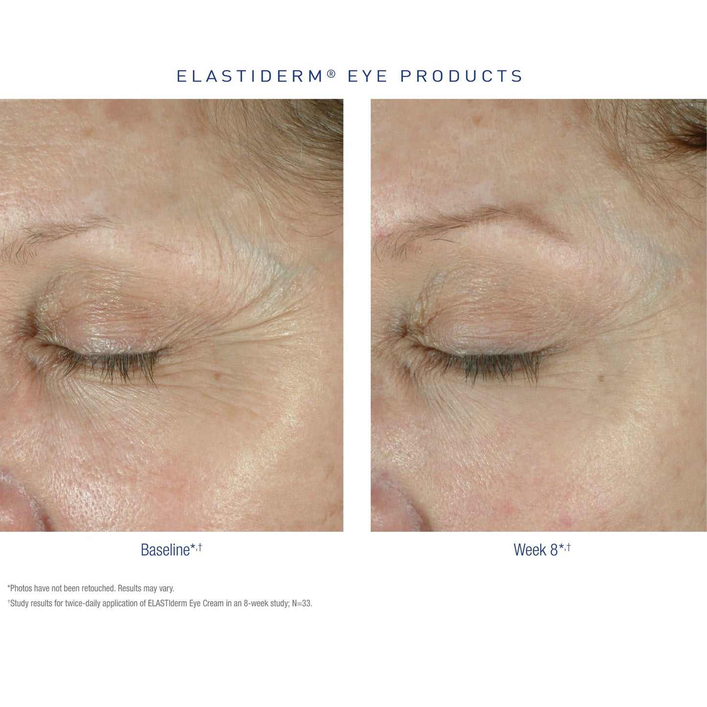 Obagi Medical ELASTIderm Eye Complete Complex Serum