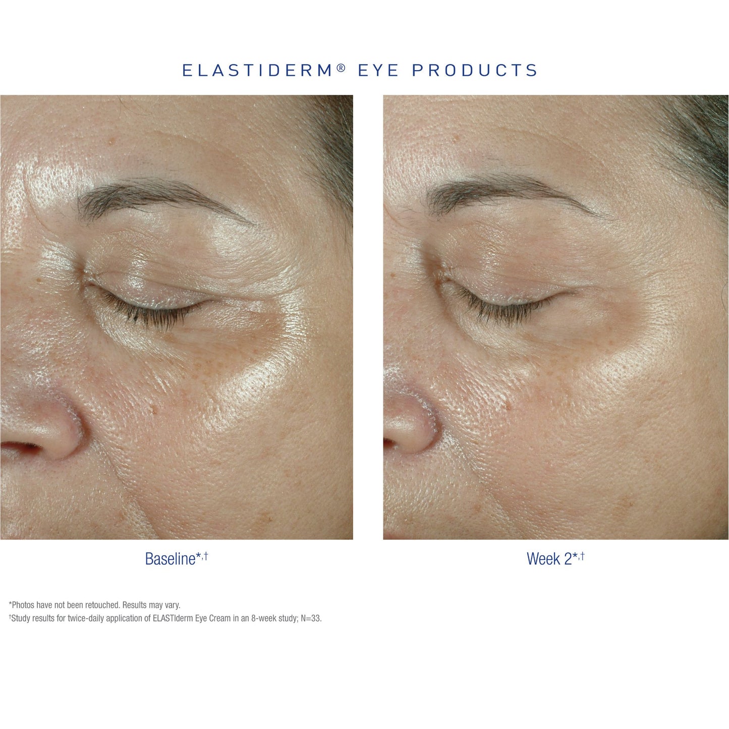 Obaji Medical ELASTIderm Facial Serum