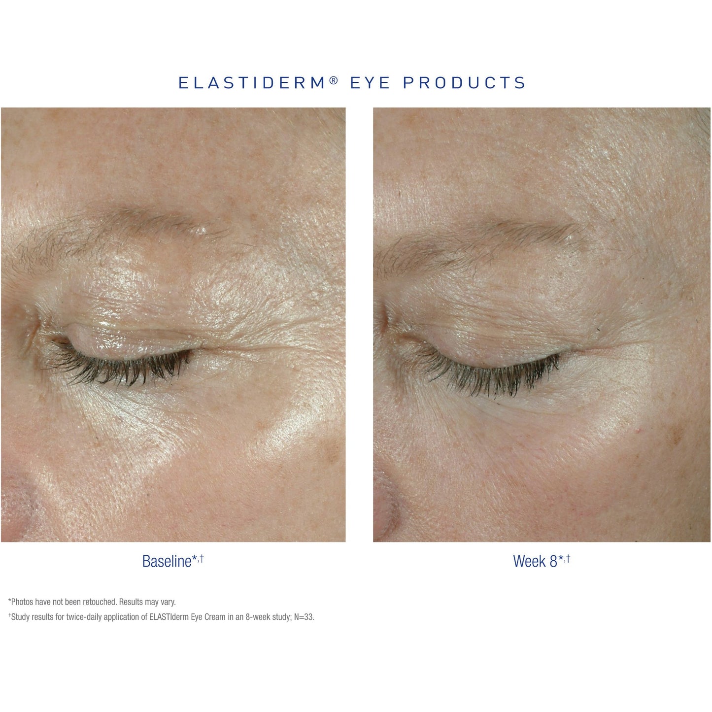 Obagi Medical ELASTIderm Eye Cream